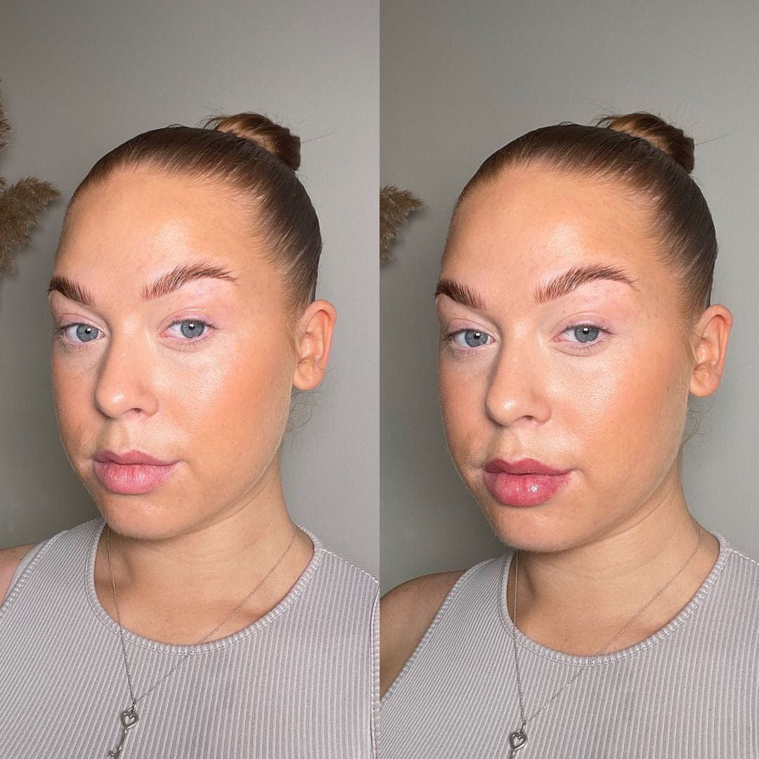 Rellenador de labios voluminizador®