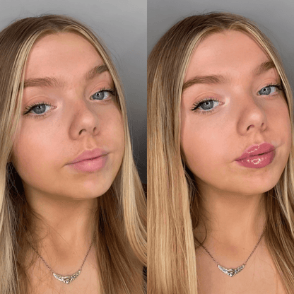 Rellenador de labios voluminizador®