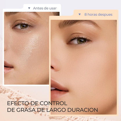 InfiniteFix® - Acabado natural
