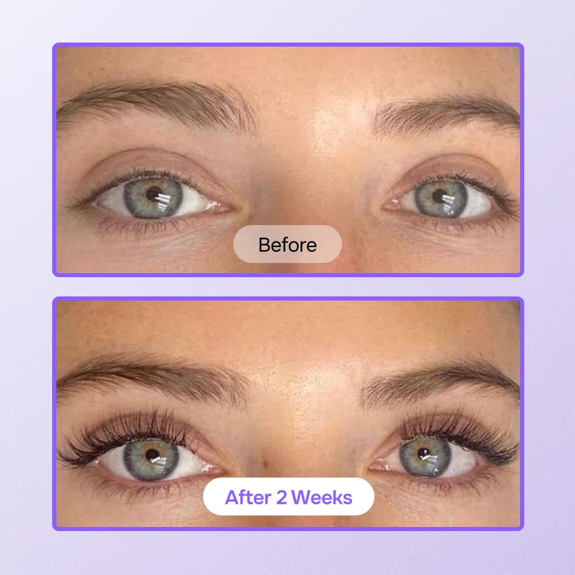 Sérum LashMagic®